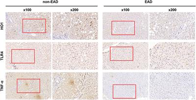 Combination of Early Allograft Dysfunction and Protein Expression Patterns Predicts Outcome of Liver Transplantation From Donation After Cardiac Death